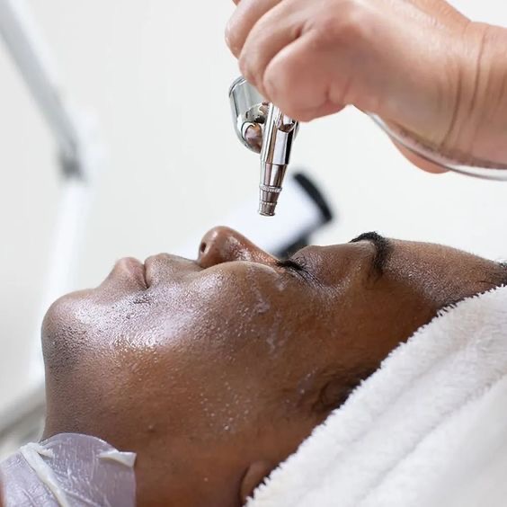 Oxygen Facial